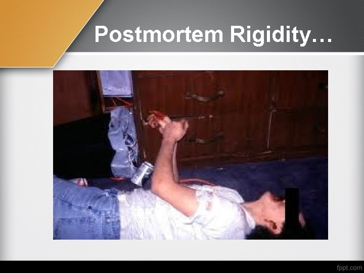 Postmortem Rigidity… 