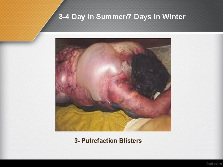 3 -4 Day in Summer/7 Days in Winter 3 - Putrefaction Blisters 