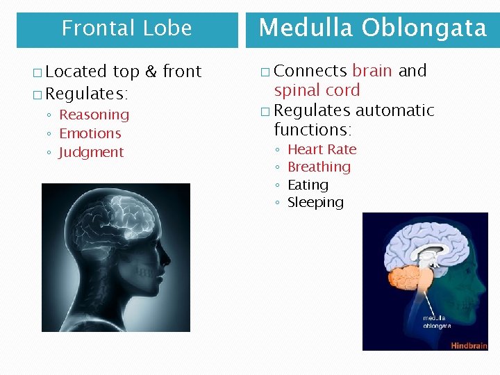 Frontal Lobe � Located top & front � Regulates: ◦ Reasoning ◦ Emotions ◦