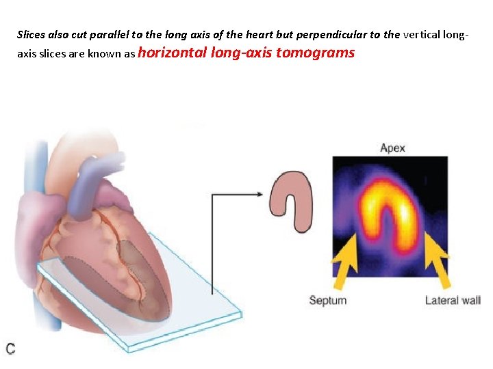 Slices also cut parallel to the long axis of the heart but perpendicular to