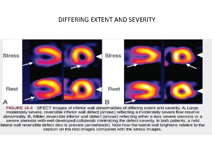 DIFFERING EXTENT AND SEVERITY 