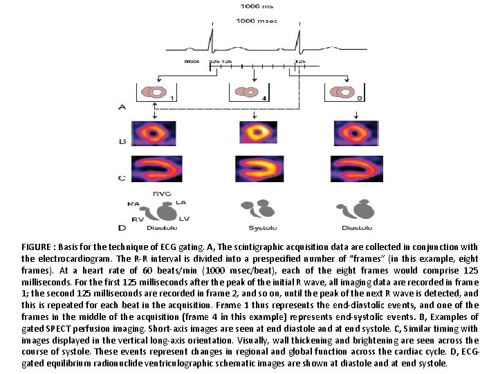 FIGURE : Basis for the technique of ECG gating. A, The scintigraphic acquisition data