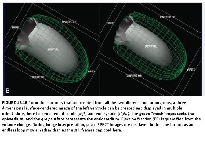 FIGURE 16. 15 From the contours that are created from all the two-dimensional tomograms,