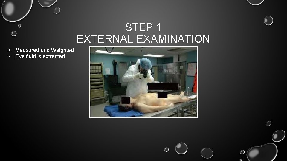 STEP 1 EXTERNAL EXAMINATION • Measured and Weighted • Eye fluid is extracted 