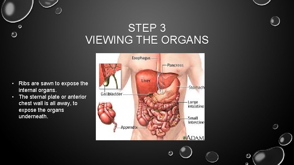 STEP 3 VIEWING THE ORGANS • Ribs are sawn to expose the internal organs.