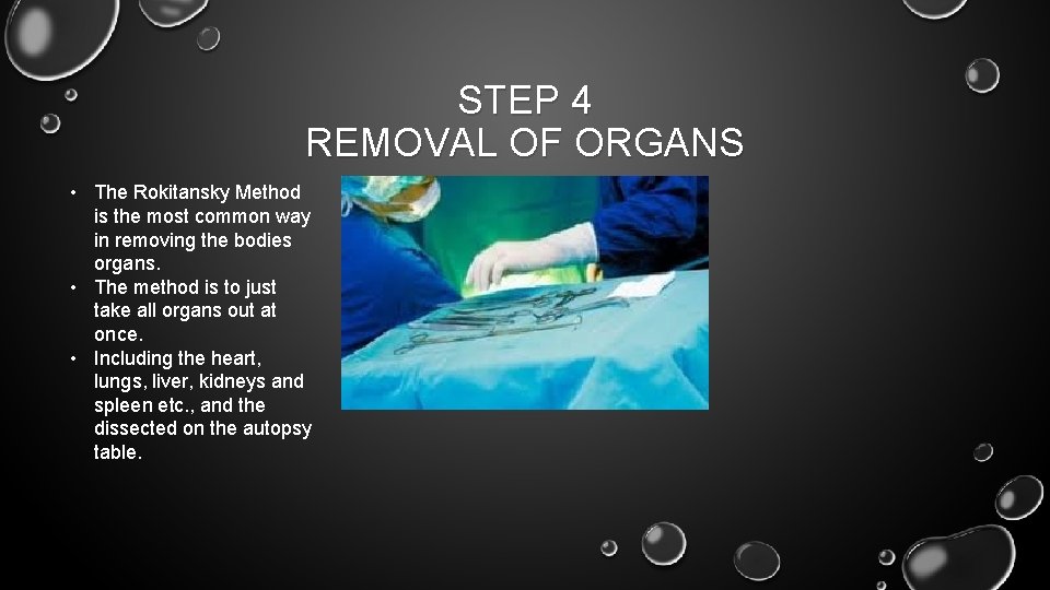 STEP 4 REMOVAL OF ORGANS • The Rokitansky Method is the most common way