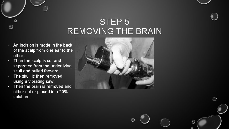 STEPS TO AN AUTOPSY BY KINIZIE MARTIN STEP