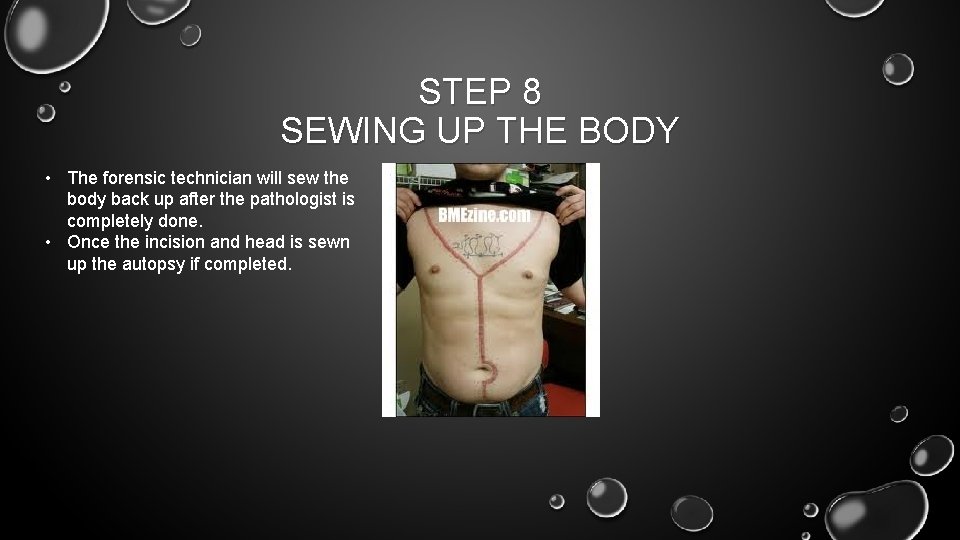 STEP 8 SEWING UP THE BODY • The forensic technician will sew the body