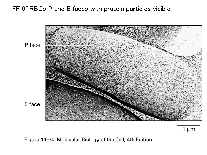 FF 0 f RBCs P and E faces with protein particles visible 
