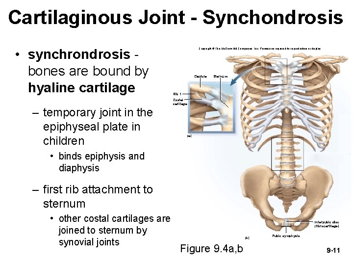 Cartilaginous Joint - Synchondrosis • synchrondrosis bones are bound by hyaline cartilage – temporary