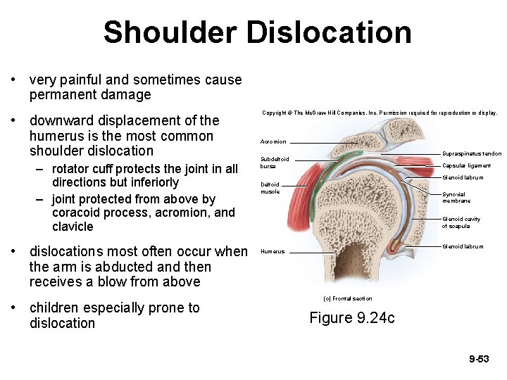 Shoulder Dislocation • very painful and sometimes cause permanent damage • downward displacement of