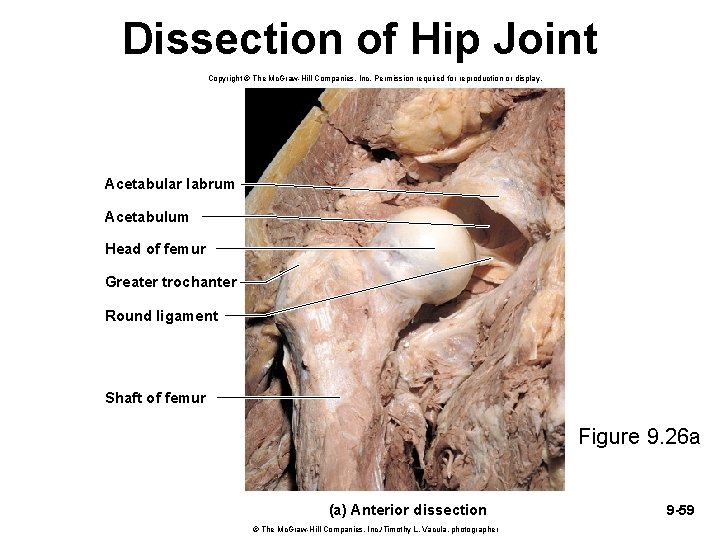 Dissection of Hip Joint Copyright © The Mc. Graw-Hill Companies, Inc. Permission required for