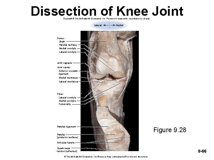 Dissection of Knee Joint Copyright © The Mc. Graw-Hill Companies, Inc. Permission required for