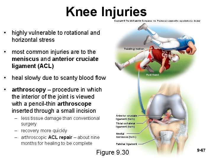 Knee Injuries Copyright © The Mc. Graw-Hill Companies, Inc. Permission required for reproduction or