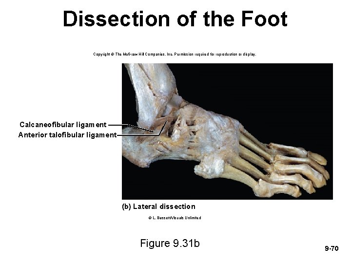 Dissection of the Foot Copyright © The Mc. Graw-Hill Companies, Inc. Permission required for