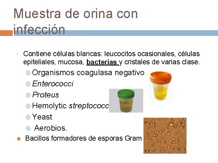 Muestra de orina con infección Contiene células blancas: leucocitos ocasionales, células epiteliales, mucosa, bacterias