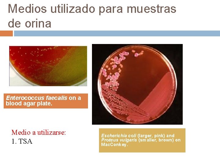 Medios utilizado para muestras de orina Enterococcus faecalis on a blood agar plate. Medio