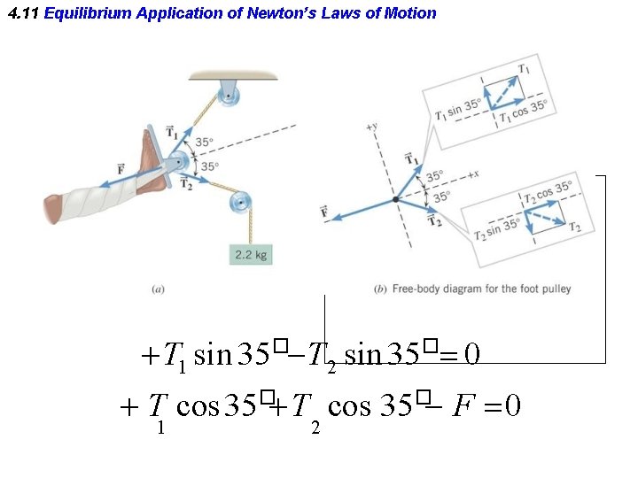 4. 11 Equilibrium Application of Newton’s Laws of Motion T 1 sin 35� T