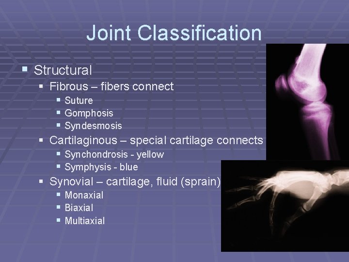 Joint Classification § Structural § Fibrous – fibers connect § Suture § Gomphosis §