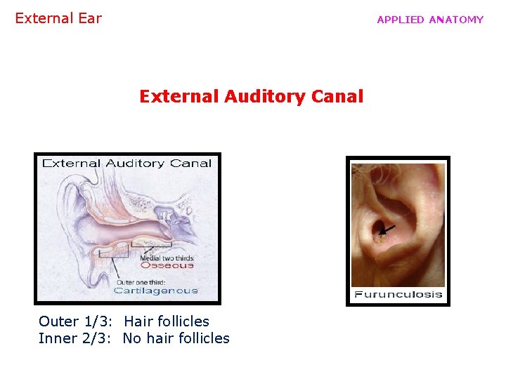 External Ear APPLIED ANATOMY External Auditory Canal Outer 1/3: Hair follicles Inner 2/3: No
