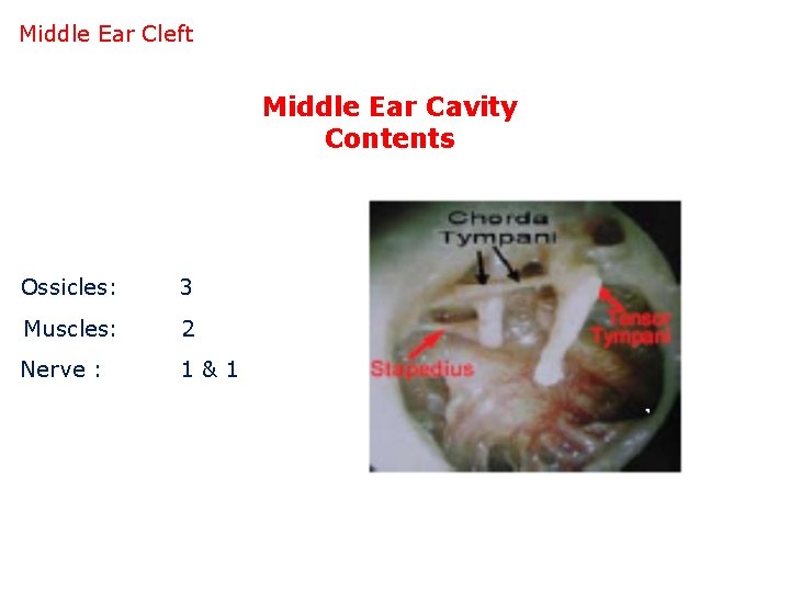 Middle Ear Cleft Middle Ear Cavity Contents Ossicles: 3 Muscles: 2 Nerve : 1&1
