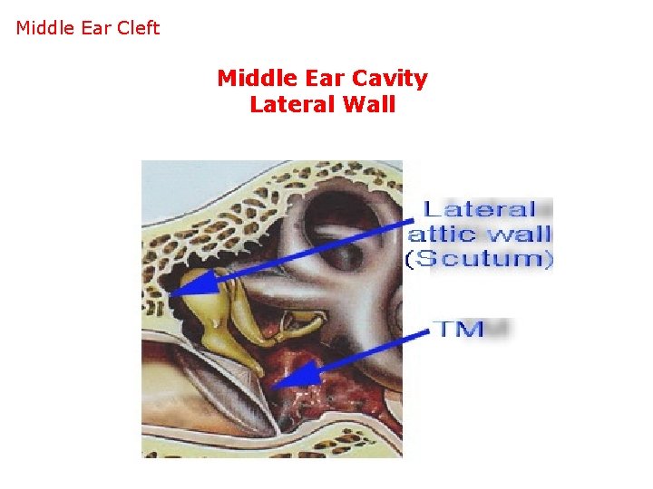 Middle Ear Cleft Middle Ear Cavity Lateral Wall 