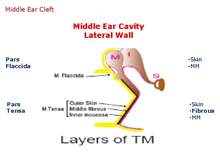 Middle Ear Cleft Middle Ear Cavity Lateral Wall Pars Flaccida • Skin • MM