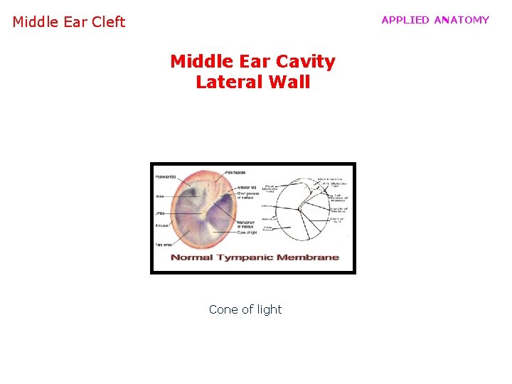 Middle Ear Cleft APPLIED ANATOMY Middle Ear Cavity Lateral Wall Cone of light 