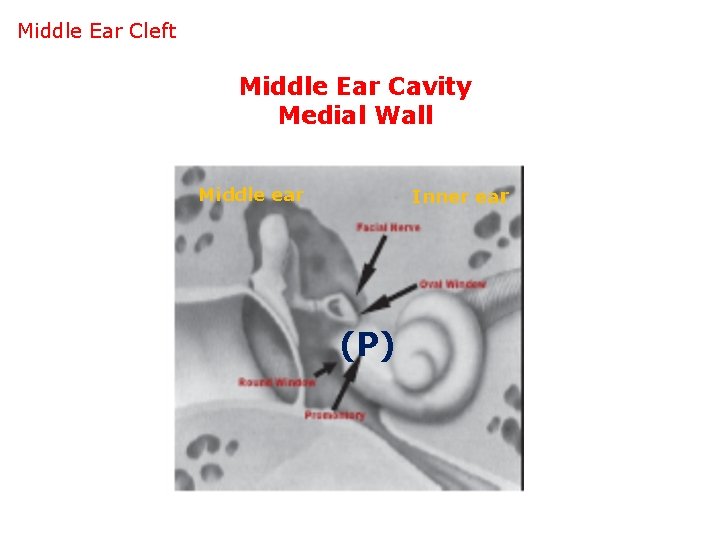 Middle Ear Cleft Middle Ear Cavity Medial Wall Inner ear Middle ear (P) 