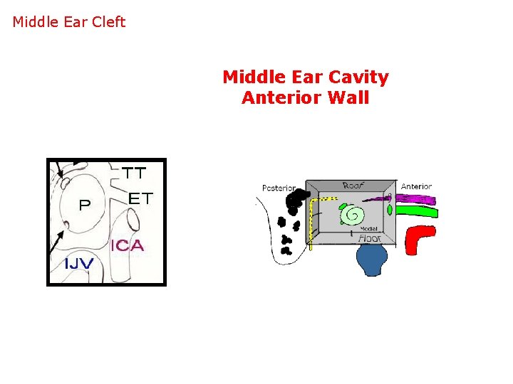 Middle Ear Cleft Middle Ear Cavity Anterior Wall 