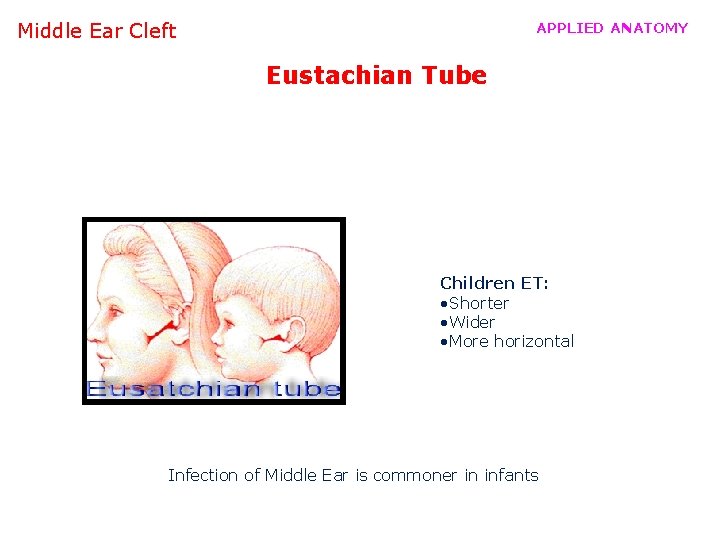 Middle Ear Cleft APPLIED ANATOMY Eustachian Tube Children ET: • Shorter • Wider •