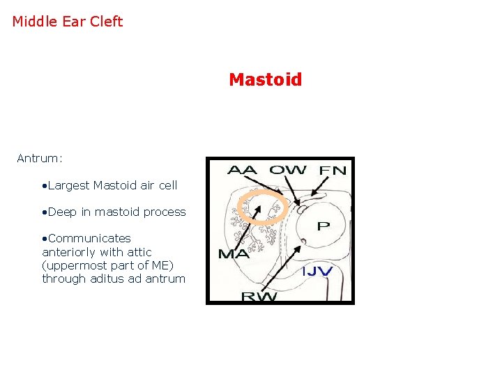 Middle Ear Cleft Mastoid Antrum: • Largest Mastoid air cell • Deep in mastoid