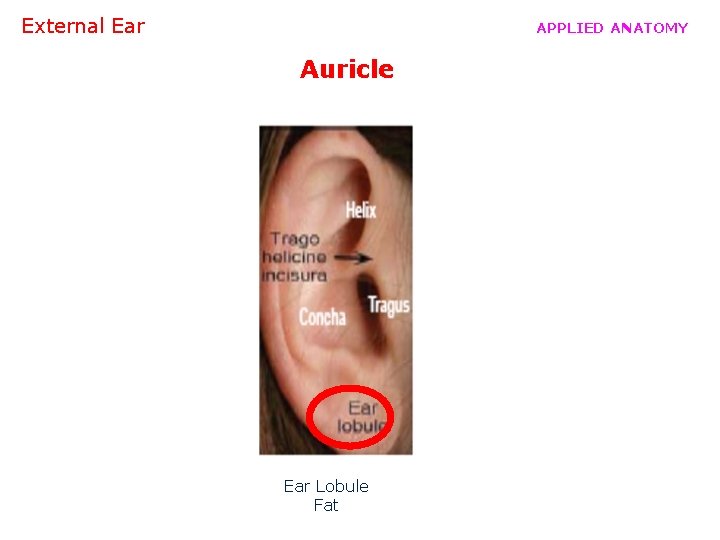 External Ear APPLIED ANATOMY Auricle Ear Lobule Fat 