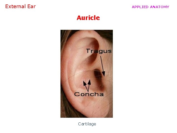 External Ear APPLIED ANATOMY Auricle Cartilage 