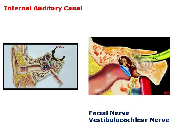 Internal Auditory Canal Facial Nerve Vestibulocochlear Nerve 