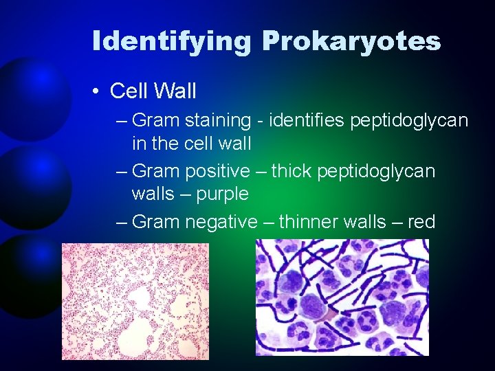 Identifying Prokaryotes • Cell Wall – Gram staining - identifies peptidoglycan in the cell