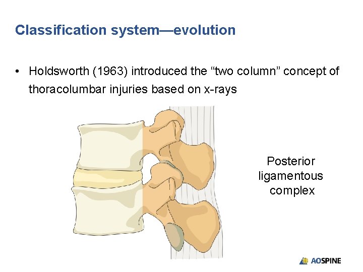 Classification system—evolution • Holdsworth (1963) introduced the “two column” concept of thoracolumbar injuries based