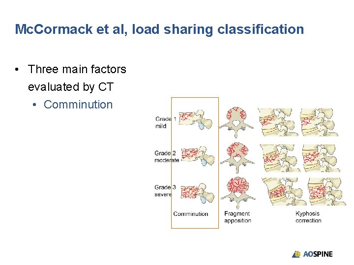 Mc. Cormack et al, load sharing classification • Three main factors evaluated by CT