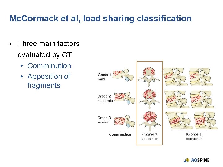 Mc. Cormack et al, load sharing classification • Three main factors evaluated by CT