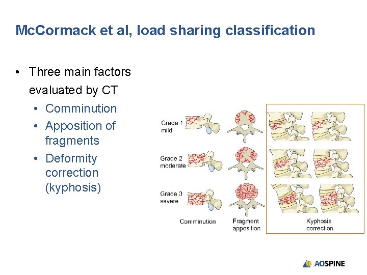 Mc. Cormack et al, load sharing classification • Three main factors evaluated by CT