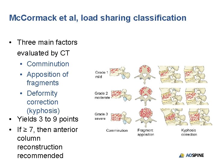 Mc. Cormack et al, load sharing classification • Three main factors evaluated by CT