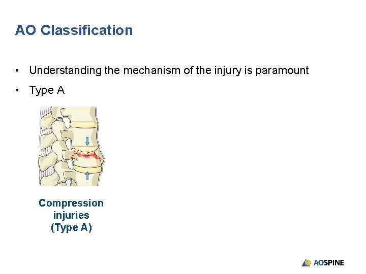 AO Classification • Understanding the mechanism of the injury is paramount • Type A