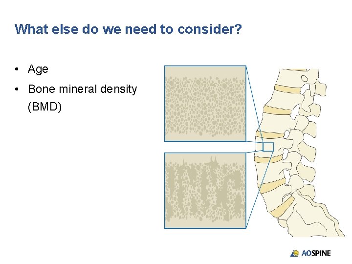 What else do we need to consider? • Age • Bone mineral density (BMD)