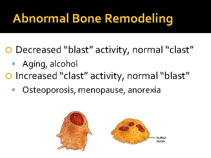 Abnormal Bone Remodeling Decreased “blast” activity, normal “clast” Aging, alcohol Increased “clast” activity, normal