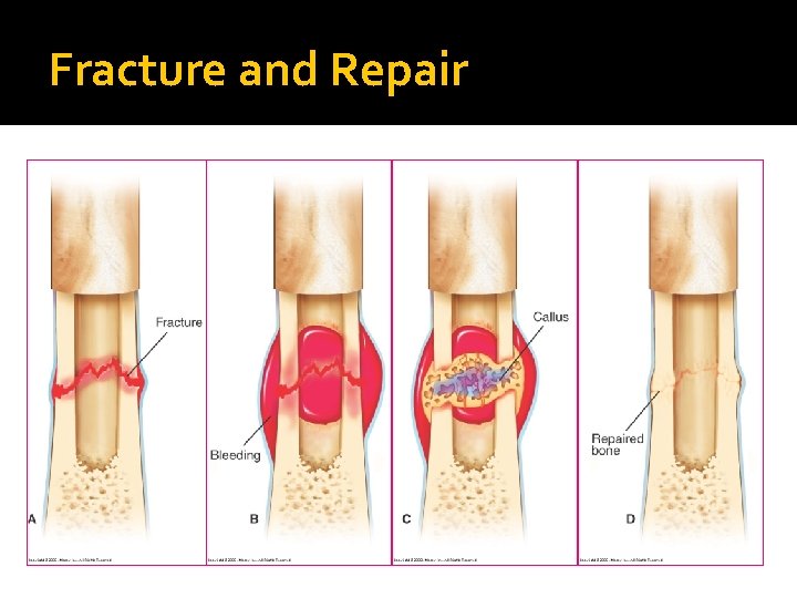 Fracture and Repair 