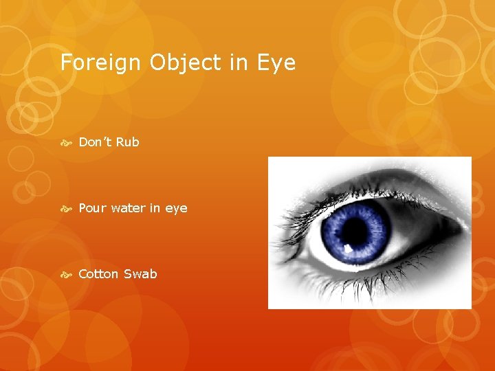 Foreign Object in Eye Don’t Rub Pour water in eye Cotton Swab 