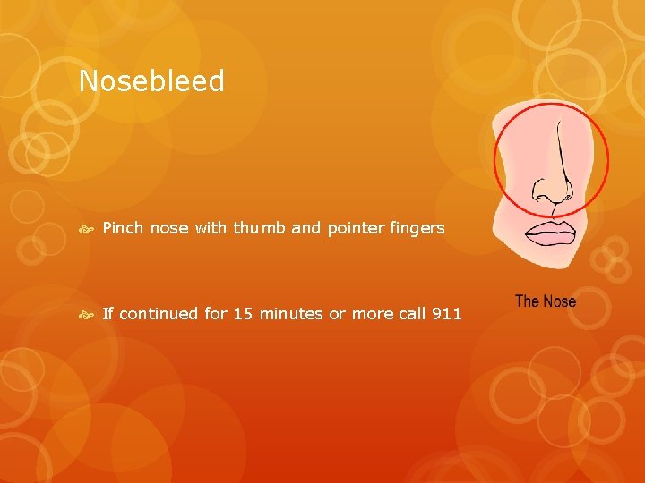 Nosebleed Pinch nose with thumb and pointer fingers If continued for 15 minutes or