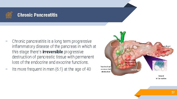 Chronic Pancreatitis ▰ Chronic pancreatitis is a long term progressive inflammatory disease of the