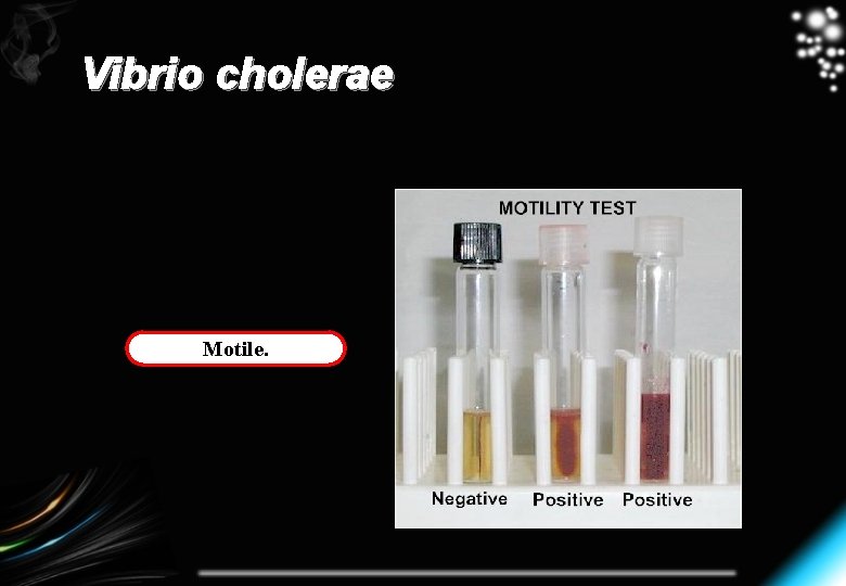 Vibrio cholerae Motile. 