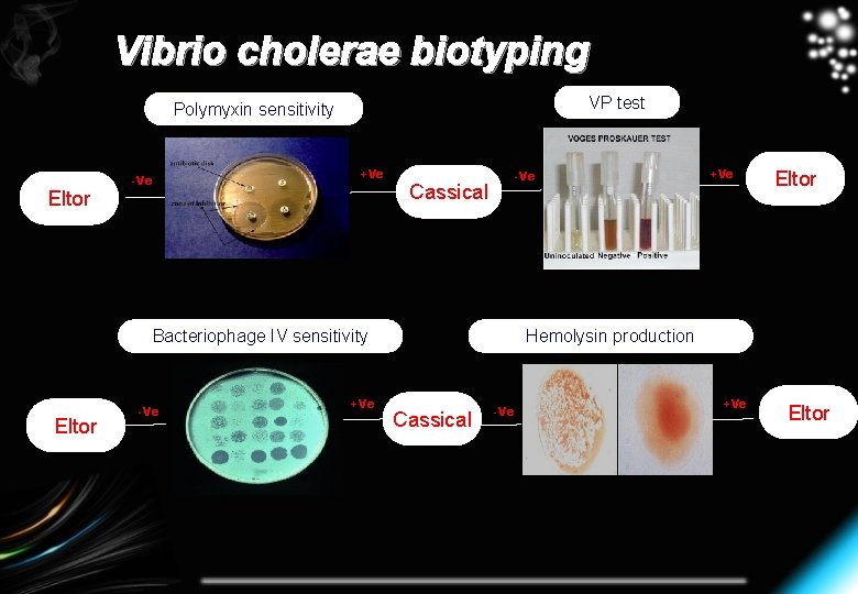Vibrio cholerae biotyping VP test Polymyxin sensitivity Eltor -Ve +Ve -Ve Cassical Bacteriophage IV